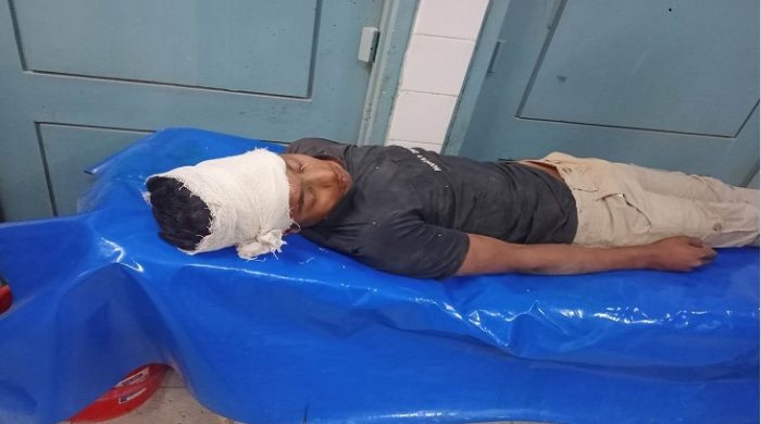 মেহেরপুরে মোটরসাইকেলের নিয়ন্ত্রণ হারিয়ে আহত-১