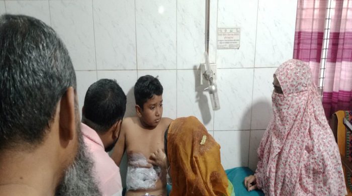 গাংনীতে বিদ্যুতস্পৃষ্টে শিশু আহত