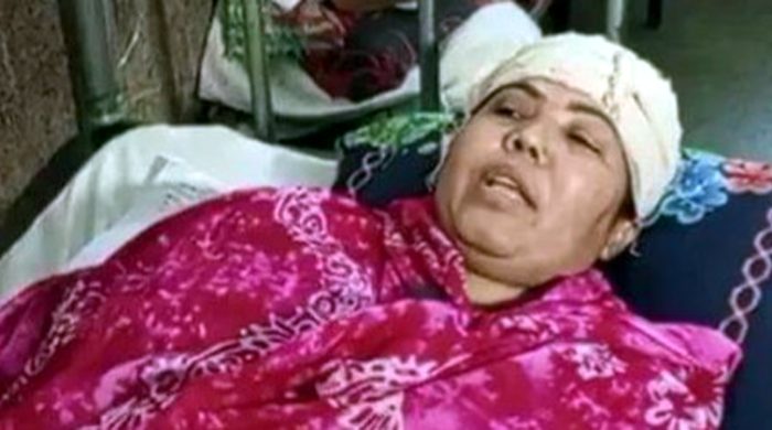 কুষ্টিয়ায় হাসপাতালের ছাদের পলেস্তার পড়ে রোগীর স্বজন আহত