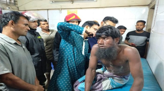 গাংনীতে অগ্নিকাণ্ডে কৃষক আহত