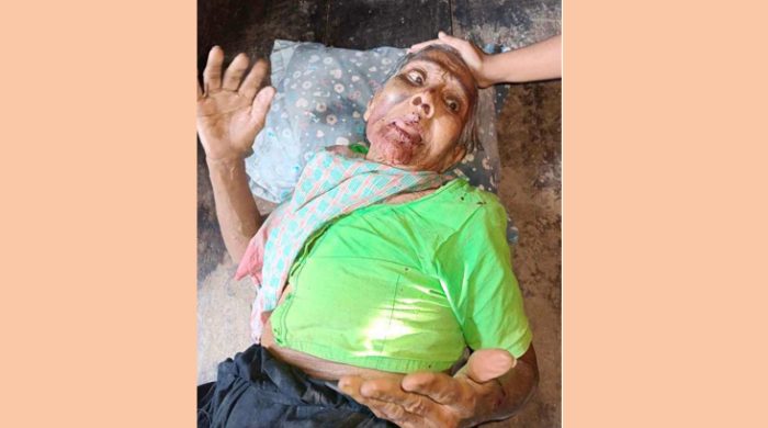 ভাত খেতে চাওয়ায় শতবর্ষী মাকে মেরে রক্তাক্ত করলো সন্তান!