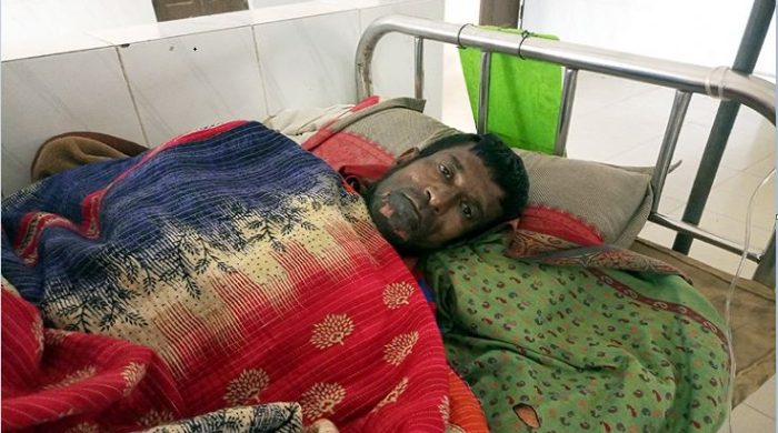 গাংনীতে আগুন পোহাতে গিয়ে অগ্নিদগ্ধ সেই সাহাদুলের মৃত্যু
