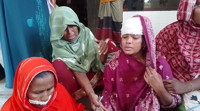 মুজিবনগরে জমি সংক্রান্ত বিরোধের জেরে দুই নারীর উপর হামলা