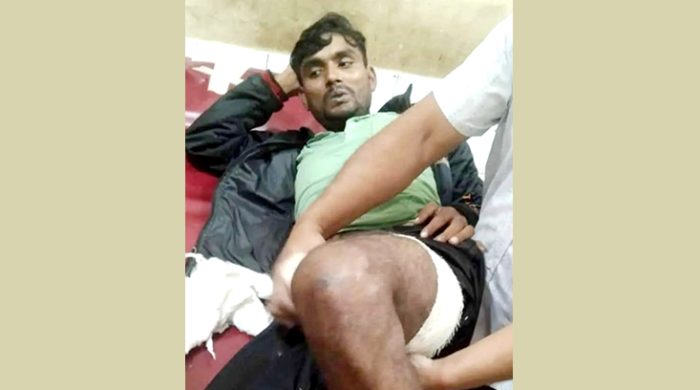 দৌলতপুর সীমান্তে মাদক চোরাকারবারীদের হামলায় যুবক গুলিবিদ্ধ