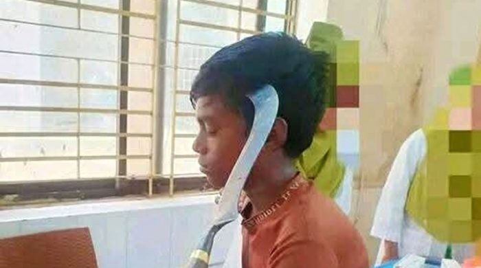 অবশেষে ২৬ ঘণ্টা পর কিশোরের মাথা থেকে কাস্তে বের করা হয়েছে