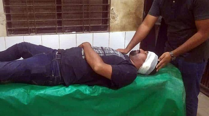 লালন মেলায় মাদক ব্যবসায়ীদের হামলায় সাংবাদিক আহত