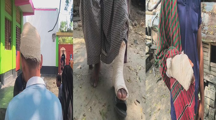 মুজিবনগরে জমি সংক্রান্ত বিরোধে হামলা, ৩ নারীসহ আহত-৬