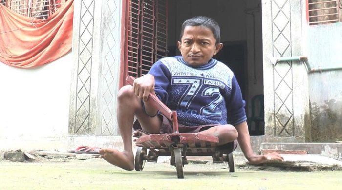২ ফিট উচ্চতার প্রতিবন্ধী সিজারের কষ্টের জীবন- চলাচল সহায়তায় চাই একটি হুইল চেয়ার