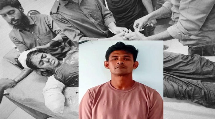 প্রেমের বিয়ের পর তালাক দেওয়ায় সাবেক স্ত্রীর ডান হাত বিচ্ছিন্ন করা অভিযুক্ত সায়ন আটক